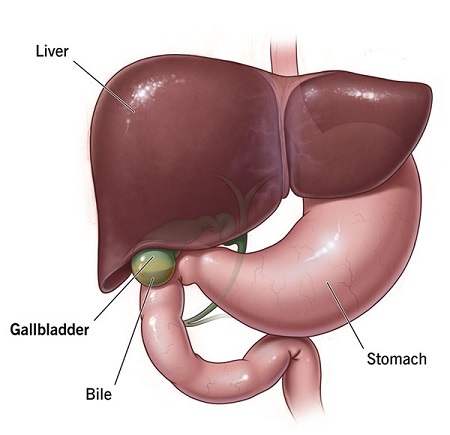 What is a gallstone Symptoms of gallstones and its treatment 3 1