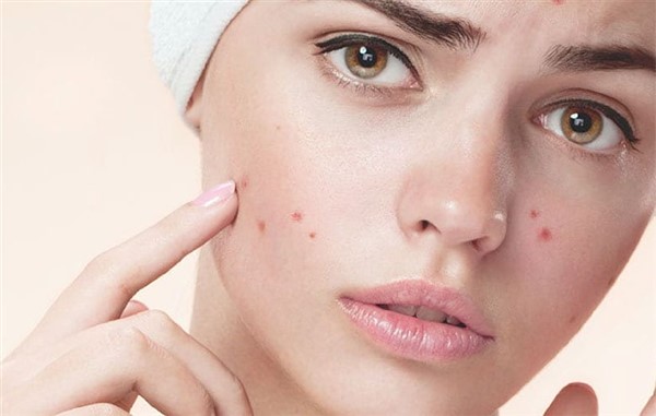 چگونه نوع پوست خود را تشخیص دهید و از آن مراقبت کنید؟