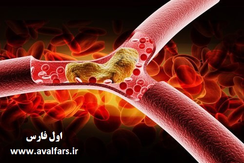 کلسترول خون