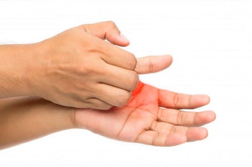 خارش کف دست 2 1