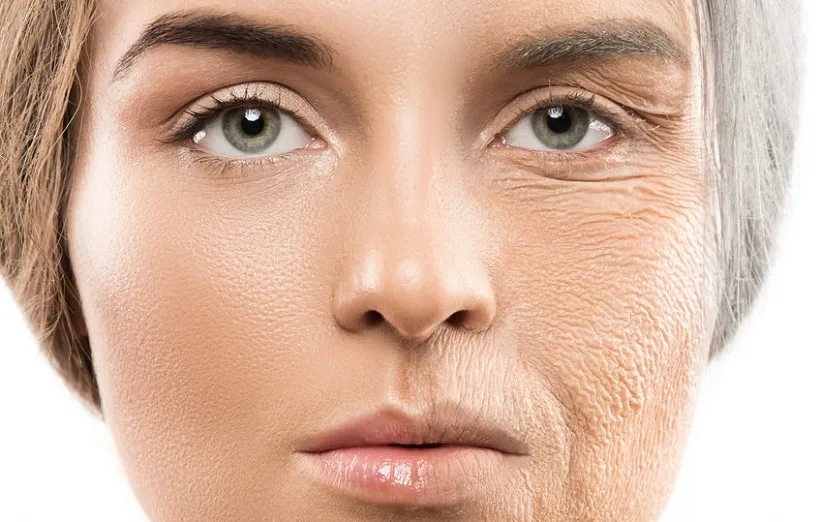 aging skin jpg