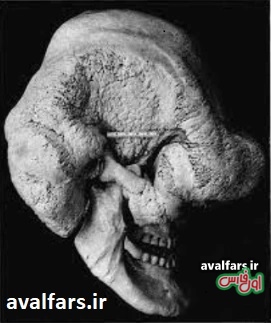 Side of siah khans skull