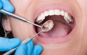 ۹ دلیل که مبتلایان به دیابت باید مواظب دهان و دندان باشند