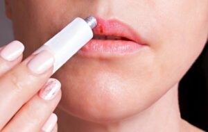 ۱۳ درمان طبیعی برای برطرف کردن سریع تبخال در خانه