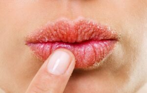 با این ۱۳ درمان‌ خانگی طبیعی برای همیشه از شر خشکی لب های خود رها شوید