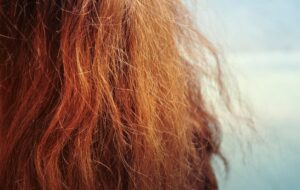 ۸ راه حل طبیعی معجزه آسا برای درمان وزی مو در خانه