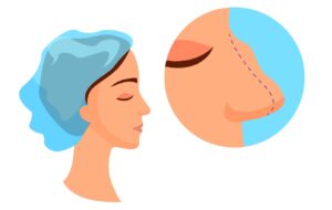 ۷ شایع و باور رایج نادرست درمورد عمل بینی که بسیار شنیده اید