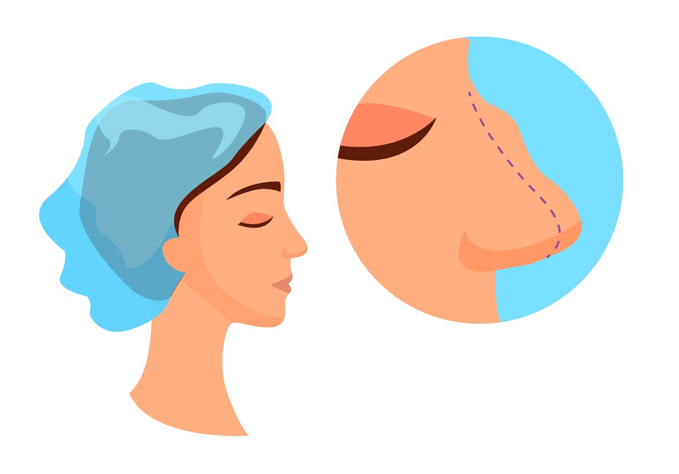شایعات رایج درمورد عمل بینی