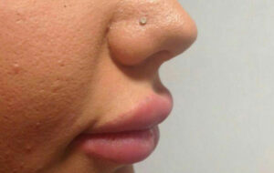 افزایش تمایل به جراحی گوش الاغی و نصف کردن زبان ، مشکل دارند؟