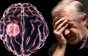 روش جدید برای درمان و ریشه‌کنی تومورهای کشنده مغز در ۵ روز