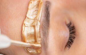 عوارض شمع انداختن پوست صورت که خانم ها باید بدانند