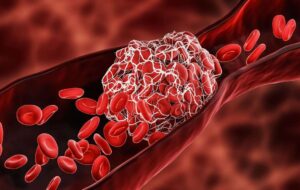 ۵ ماده غذایی کشنده برای غلظت خون بالا