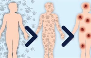 علائم و نشانه های اصلی تجمع سموم در بدن