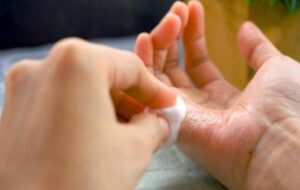 ۷ روش کاربردی برای پاک کردن چسب ۱۲۳ از روی دست به راحتی