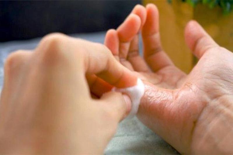 پاک کردن چسب 123 از روی دست