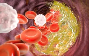 الان وقتشه بدونین استرس چگونه کلسترول خون را بالا می‌برد؟