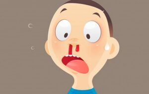 راه قطع فوری خونریزی بینی و جلوگیری از خون دماغ شدن بطور صحیح