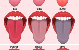 رنگ‌ زبان چه خبری از سلامتی ما می دهد؟