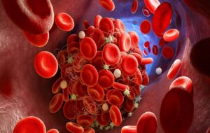 ۱۱ نشانه مهم لخته شدن خون در بدن که هرگز نباید نادیده بگیرید