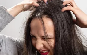 معرفی بهترین درمان های خانگی سریع و موثر شپش سر