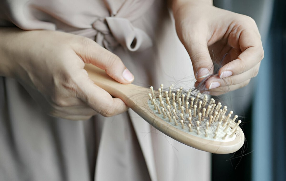 hormonal hair loss 5