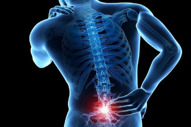 کدام کمردرد ها باید جراحی شوند؟