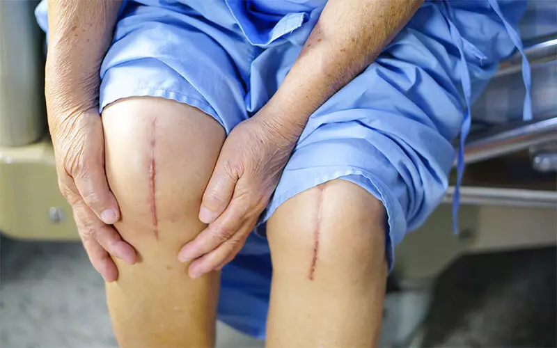 How to perform knee joint replacement surgery