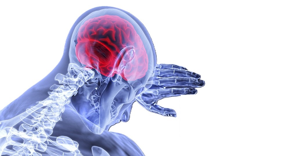 Stroke in Iran