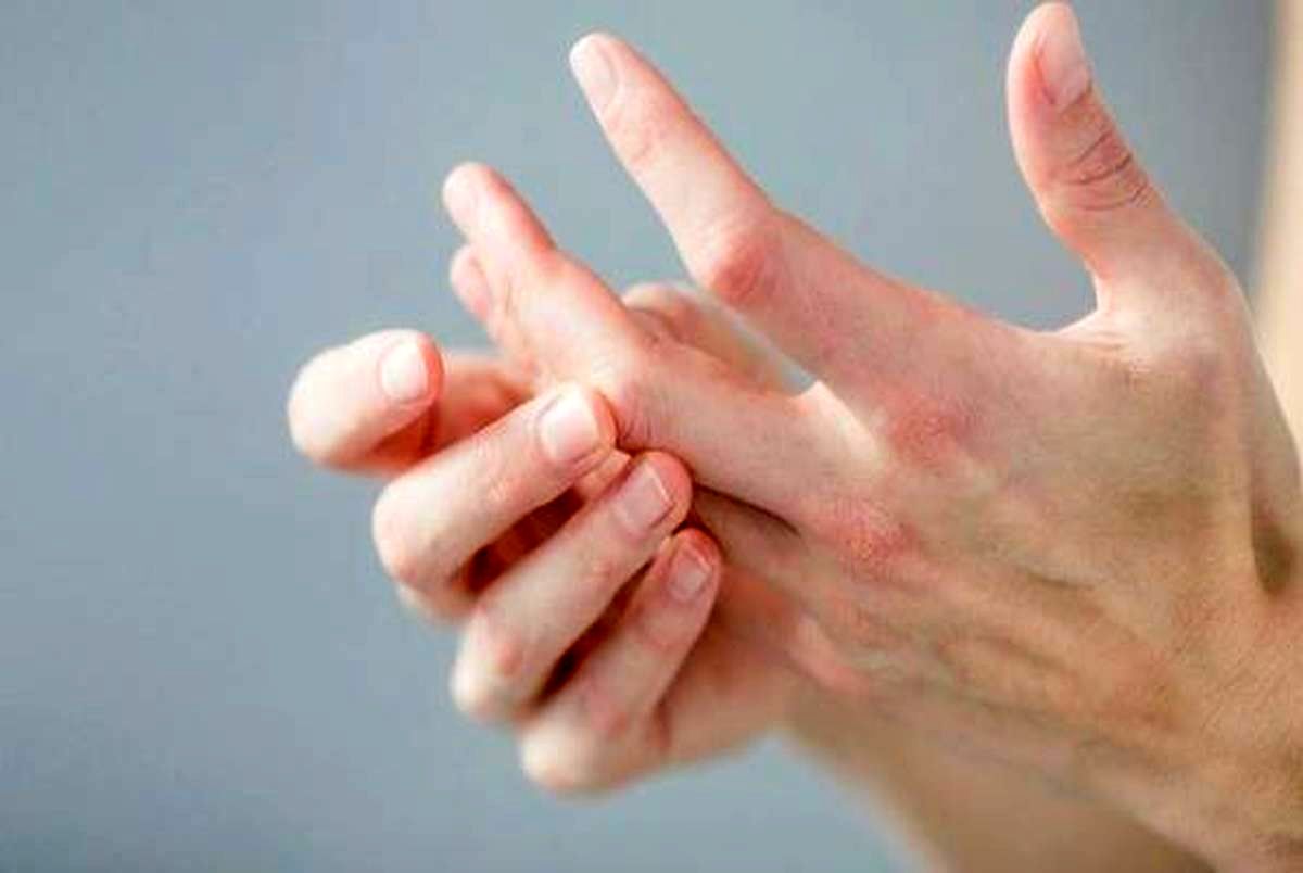 ۹ نشانه روی دست ها که به ما خبر از بیماری می دهد!