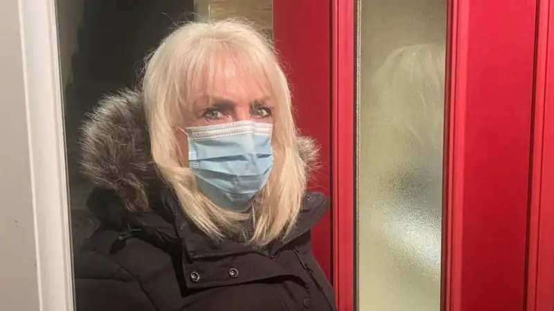 زنی پس از تزریق فیلر صورت شبیه گارگویل‌ شد