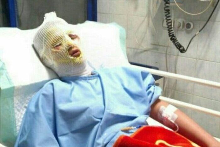 انفجار ترقه