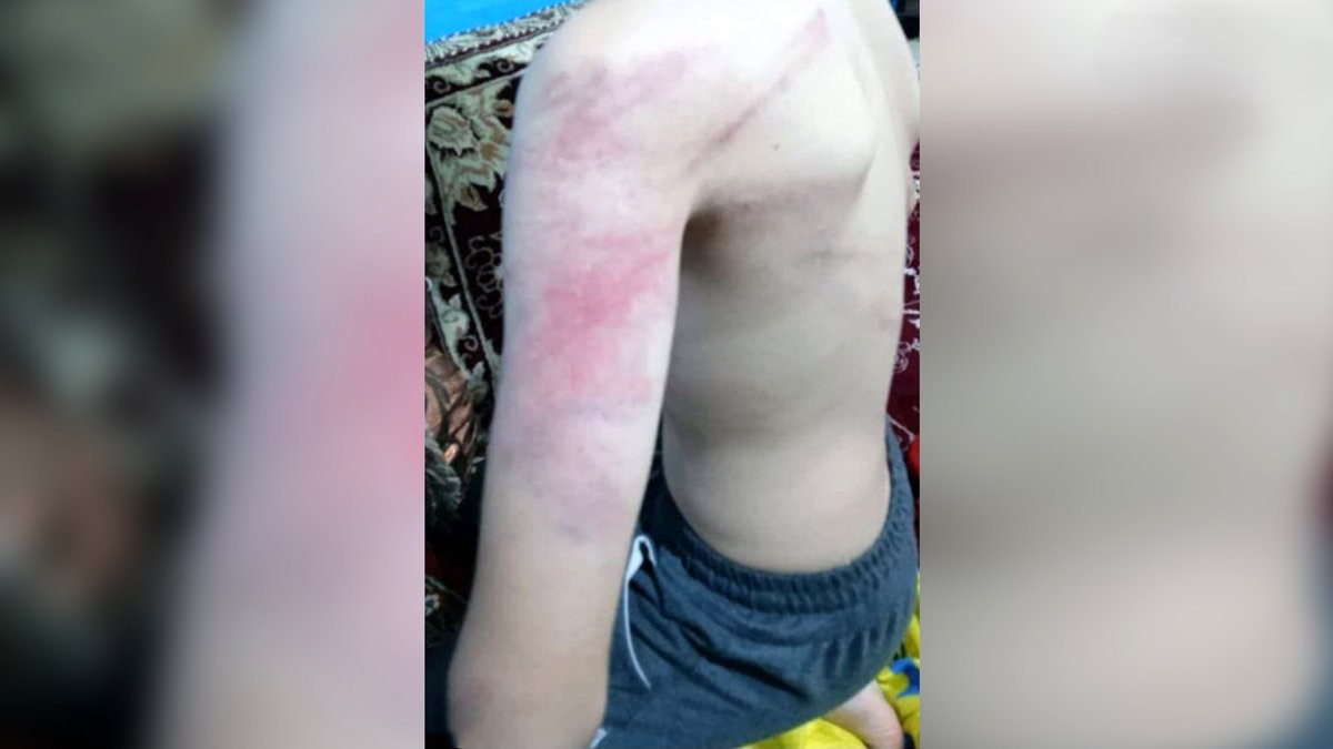 عکسهای تکان‌دهنده ضرب‌وشتم وحشیانه دانش‌آموزان توسط معلم دبستان کرجو