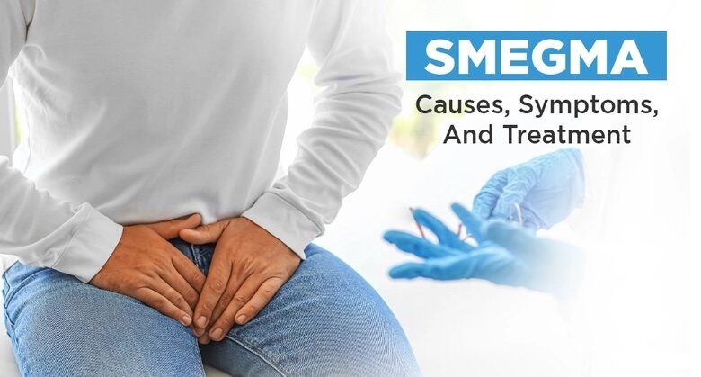 smegma 4157