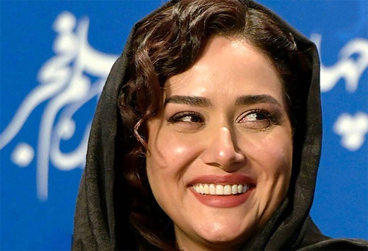 لمینت دندان، بهترین راه اصلاح لبخند دهه شصتی‌ها