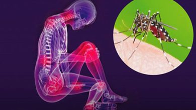 chikungunya