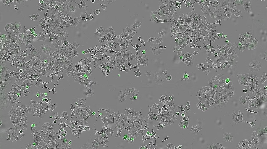 کشف پروتئینی در باکتری وبا که باعث «خودتخریبی سلول‌های سرطانی» ‏می‌‌شود