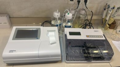 راهاندازی دستگاه پیشرفته «الایزا» در شیراز برای آزمایشات دقیق ایدز و هپاتیت 4 الایزا