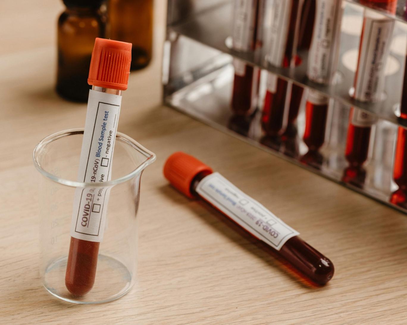 فقط ۵۰ نفر در جهان «خون طلایی» دارند