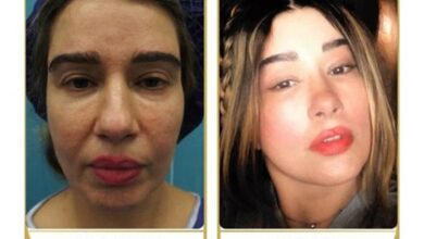 لیفتصورتوگردنوهزینهآن 1