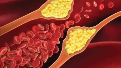 این میوه قاتل چربی خون است