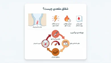 شقاق مقعدی چیست و چرا در مرکز تهران باید زود درمان شود؟ مسیر تشخیص تا درمان در مطب دکتر قمری