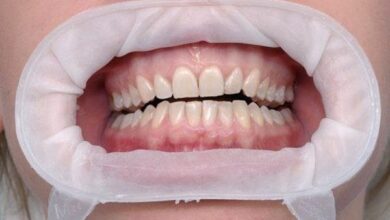 شکار دختران دم‌بخت در مطب خیالی؛ دندانپزشک قلابی با کلت کمری به خواستگاری رفت!