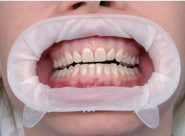 شکار دختران دم‌بخت در مطب خیالی؛ دندانپزشک قلابی با کلت کمری به خواستگاری رفت!