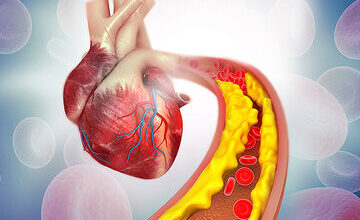 تولید یک قرص جدید برای کاهش کلسترول «بد» تا ۶۰ درصد