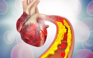 تولید یک قرص جدید برای کاهش کلسترول «بد» تا ۶۰ درصد
