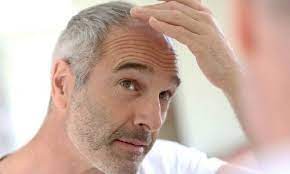 استرس واقعا عامل سفیدشدن مو است؟ علت سفیدی مو و راه درمان آن