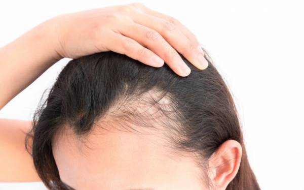 ۵ روش عملی برای جلوگیری از ریزش مو که باید بدانید !