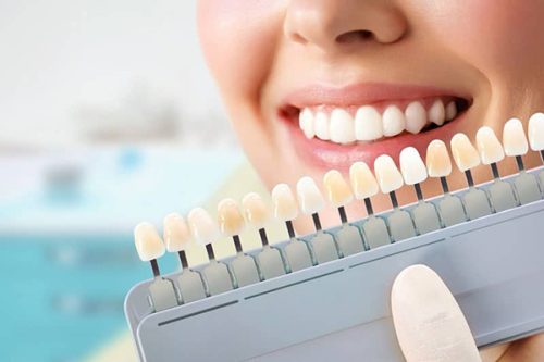 سفید کردن دندان  ۵ روش پزشکی و ۱۰ روش خانگی سفیدی دندان