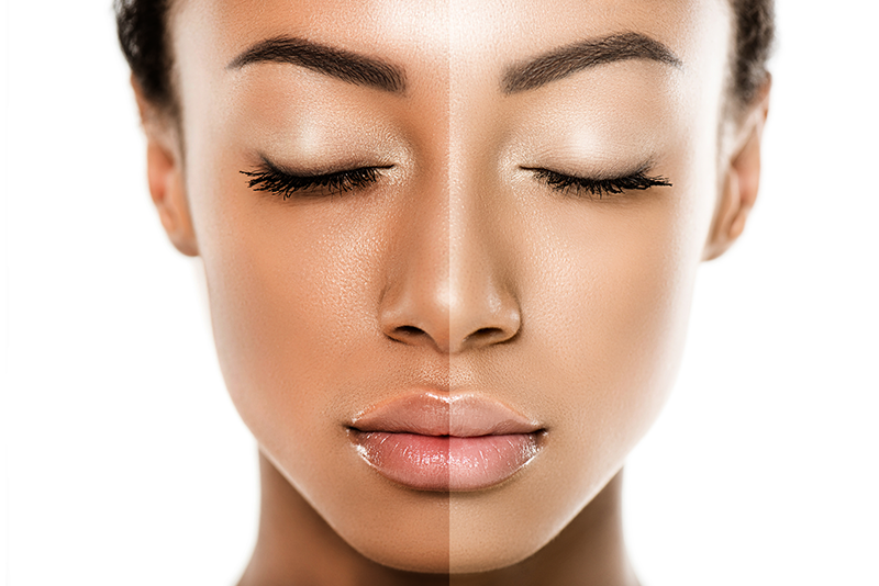 ۱۲ روش موثر خانگی برای سفید و شفاف تر شدن طبیعی پوست