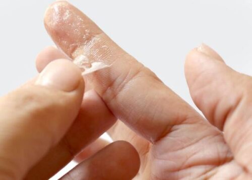 پاک کردن چسب قطره ای از روی پوست